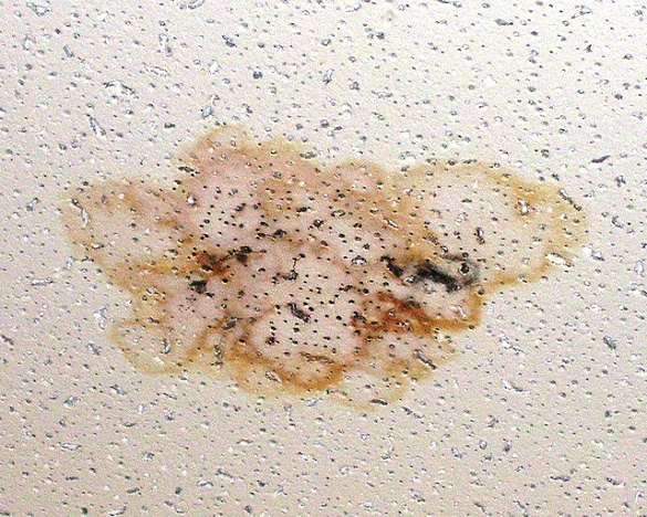 Ceiling Stains Are Signs Of A Roof Leak Roofer911